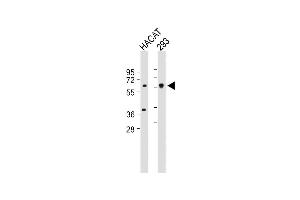 All lanes : Anti-SGPL1 Antibody (N-term) at 1:1000 dilution Lane 1: HACAT whole cell lysate Lane 2: 293 whole cell lysate Lysates/proteins at 20 μg per lane. (SGPL1 抗体  (N-Term))