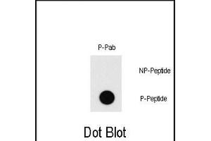 Dot blot analysis of Phospho-MEF2C-T20 Pab (Cat. (MEF2C 抗体  (pThr20))
