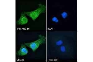 ABIN184830 Immunofluorescence analysis of paraformaldehyde fixed HeLa cells, permeabilized with 0. (TRIM37 抗体  (C-Term))