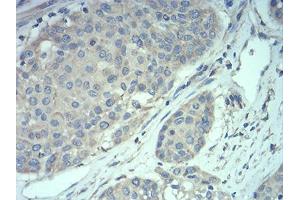 Immunohistochemistry (IHC) image for anti-Methyl CpG Binding Protein 2 (MECP2) (AA 7-148) antibody (ABIN5889789) (MECP2 抗体  (AA 7-148))