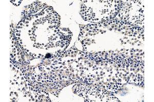 ABIN7096380 and ABIN7100444 at 1/100 staining mouse testis tissue by IHC-P. (PMPCA 抗体)