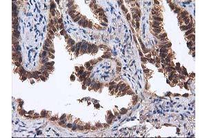 Image no. 10 for anti-Destrin (Actin Depolymerizing Factor) (DSTN) antibody (ABIN1497910) (Destrin 抗体)