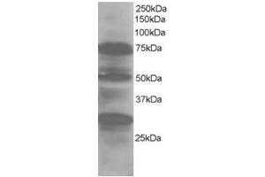 Image no. 1 for anti-LIM Domain 7 (LMO7) (Internal Region) antibody (ABIN374384) (LMO7 抗体  (Internal Region))