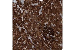 Immunohistochemical staining of human pancreas with YRDC polyclonal antibody  shows strong cytoplasmic positivity in exocrine glandular cells and Islet cells. (YRDC 抗体)