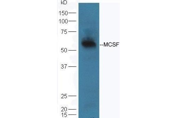 M-CSF/CSF1 抗体  (AA 201-300)