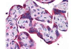 Immunohistochemistry (IHC) image for anti-ATG5 Autophagy Related 5 (ATG5) (C-Term) antibody (ABIN311668) (ATG5 抗体  (C-Term))