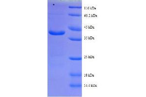 SDS-PAGE (SDS) image for Cytochrome C Oxidase Subunit Va (COX5A) (AA 42-150), (full length) protein (GST tag) (ABIN7479239)