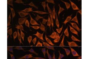 Immunofluorescence analysis of L929 cells using MRPS35 Polyclonal Antibody at dilution of 1:100. (MRPS35 抗体)