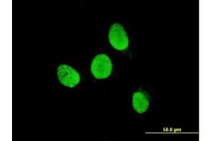 Immunofluorescence of monoclonal antibody to TESK2 on HeLa cell. (TESK2 抗体  (AA 405-542))