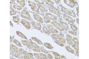 Immunohistochemistry of paraffin-embedded Mouse stomach using MSMB Polyclonal Antibody at dilution of 1:100 (40x lens). (MSMB 抗体)