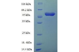 ACBD4 Protein (AA 1-305, full length) (His-SUMO Tag)