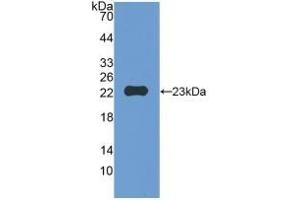 Detection of Recombinant MMP12, Mouse using Polyclonal Antibody to Matrix Metalloproteinase 12 (MMP12) (MMP12 抗体  (AA 294-473))