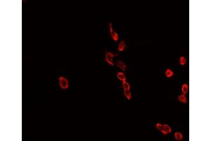 ABIN6268808 staining MCF-7 cells by IF/ICC. (HNRNPL 抗体  (N-Term))