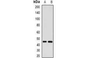 Western blot analysis of GP73 expression in SKOV3 (A), SHSY5Y (B) whole cell lysates. (GOLM1 抗体)