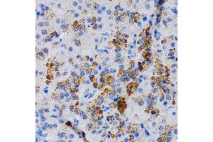 Immunohistochemistry of paraffin-embedded rat pancreas using CYP24 antibody (805) at dilution of 1:200 (40x lens). (CYP24A1 抗体  (AA 36-448))