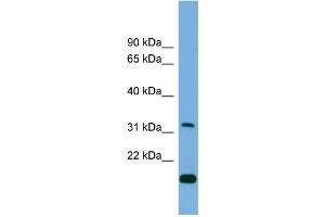 Western Blotting (WB) image for anti-CTD (Carboxy-terminal Domain, RNA Polymerase II, Polypeptide A) Small Phosphatase 2 (CTDSP2) (Middle Region) antibody (ABIN2774003)
