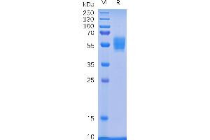 SDS-PAGE (SDS) image for Killer Cell Lectin-Like Receptor Subfamily K, Member 1 (KLRK1) protein (mFc Tag) (ABIN6961134)