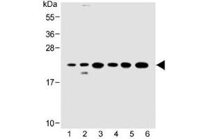 Western blot testing of 1) human HeLa, 2) human 293/T17, 3) mouse C2C12, 4) rat C6, 5) human HT-29 and 6) rat PC-12 cell lysate with KRAS antibody at 1:500.