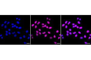 anti-PRP4 Pre-mRNA Processing Factor 4 Homolog (PRPF4) antibody