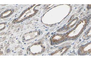 ABIN6277549 at 1/100 staining Human prostate tissue by IHC-P. (Cullin 5 抗体  (Internal Region))