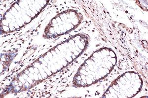 Immunohistochemistry of paraffin-embedded human colon using KIF4A Rabbit mAb (ABIN7268134) at dilution of 1:100 (40x lens). (KIF4A 抗体)