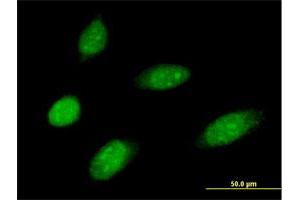 Immunofluorescence of purified MaxPab antibody to MMS19 on HeLa cell. (MMS19 抗体  (AA 1-293))