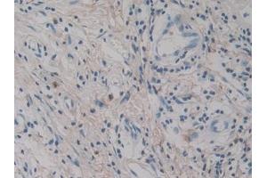 Immunohistochemistry (IHC) image for anti-Interleukin 12 alpha (IL12A) (AA 23-219) antibody (ABIN7428245)