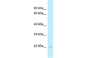 WB Suggested Anti-Tsen15 Antibody Titration: 1. (TSEN15 抗体  (C-Term))