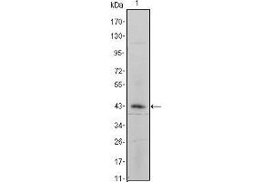 Western blot analysis using ITGA5 mouse mAb against ITGA5-hIgGFc transfected HEK293 cell lysate. (ITGA5 抗体)