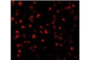 Immunofluorescence of ATF6 in MCF7 cells with this product atF6 antibody at 10 µg/ml.