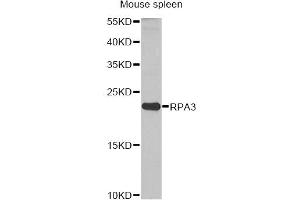 Western blot analysis of extracts of mouse spleen, using RPA3 antibody. (RPA3 抗体)