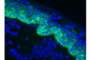 Image no. 2 for anti-Keratin 14 (KRT14) antibody (ABIN335329) (KRT14 抗体)
