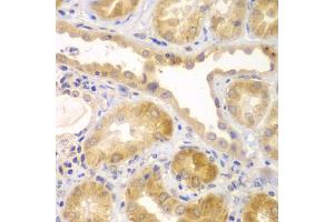 Immunohistochemistry of paraffin-embedded human kidney using UBA6 antibody (ABIN5975585) at dilution of 1/100 (40x lens). (UBA6 抗体)