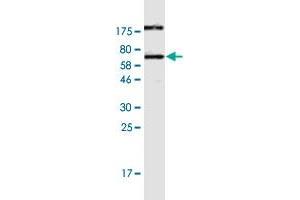 Western Blot detection against Immunogen (63. (CALU 抗体  (AA 1-315))