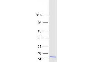 Western Blotting (WB) image for Secreted LY6/PLAUR Domain Containing 1 (SLURP1) protein (Myc-DYKDDDDK Tag) (ABIN2732206)