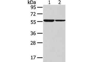 Gel: 8 % SDS-PAGE, Lysate: 40 μg, Lane 1-2: K562 and hepg2 cell, Primary antibody: ABIN7192521(SLC7A11 Antibody) at dilution 1/300 dilution, Secondary antibody: Goat anti rabbit IgG at 1/8000 dilution, Exposure time: 30 seconds (SLC7A11 抗体)