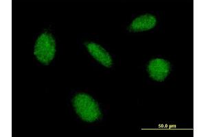 Immunofluorescence of purified MaxPab antibody to CAMK4 on HeLa cell. (CAMK4 抗体  (AA 1-473))