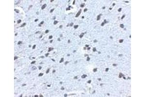Immunohistochemistry of APP in mouse brain tissue with APP antibody at 2.
