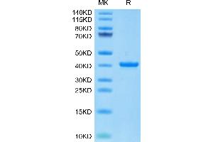 Cynomolgus ANXA1 on Tris-Bis PAGE under reduced condition. (Annexin a1 Protein (AA 2-346) (His tag))