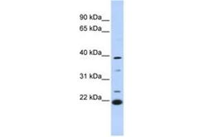 Image no. 1 for anti-Penta-EF-Hand Domain Containing 1 (PEF1) (AA 180-229) antibody (ABIN6744280) (PEF1 抗体  (AA 180-229))