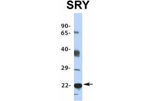 Host:  Rabbit  Target Name:  SRY  Sample Type:  HepG2  Antibody Dilution:  1. (SRY 抗体  (Middle Region))