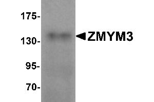 Western Blotting (WB) image for anti-Zinc Finger Protein 261 (ZMYM3) (C-Term) antibody (ABIN1030826)