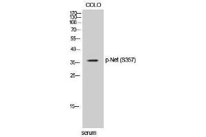 Western Blotting (WB) image for anti-ELK3, ETS-Domain Protein (SRF Accessory Protein 2) (ELK3) (pSer357) antibody (ABIN3182797) (ELK3 抗体  (pSer357))