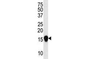 Western blot analysis of SUMO4 antibody (V55 Mutant) in HepG2 lysate. (SUMO4 抗体  (Met55Val-Mutant))
