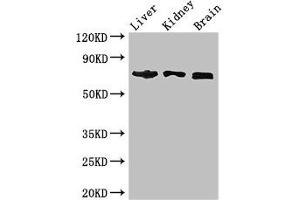 Western Blot Positive WB detected in: Mouse liver tissue, Mouse kidney tissue, Mouse brain tissue All lanes: TCF4 antibody at 2. (TCF4 抗体  (AA 419-525))