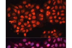Immunofluorescence analysis of HeLa cells using ABCB8 Polyclonal Antibody at dilution of 1:100 (40x lens). (ABCB8 抗体)