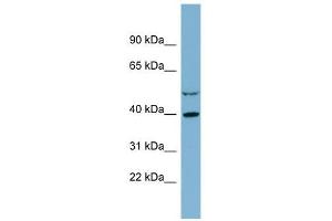 IDH3A antibody used at 1 ug/ml to detect target protein. (IDH3A 抗体)