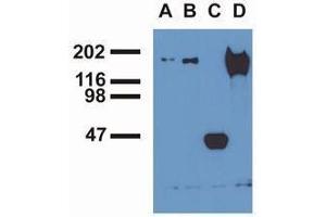Western Blotting (WB) image for anti-Epidermal Growth Factor Receptor (EGFR) (pTyr1016) antibody (ABIN400878) (EGFR 抗体  (pTyr1016))