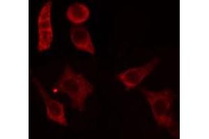 ABIN6279106 staining HepG2 cells by IF/ICC. (ACER1 抗体  (Internal Region))