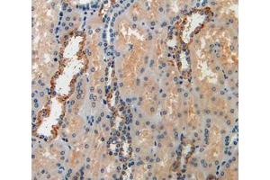 IHC-P analysis of kidney tissue, with DAB staining. (IGFBP6 抗体  (AA 31-240))